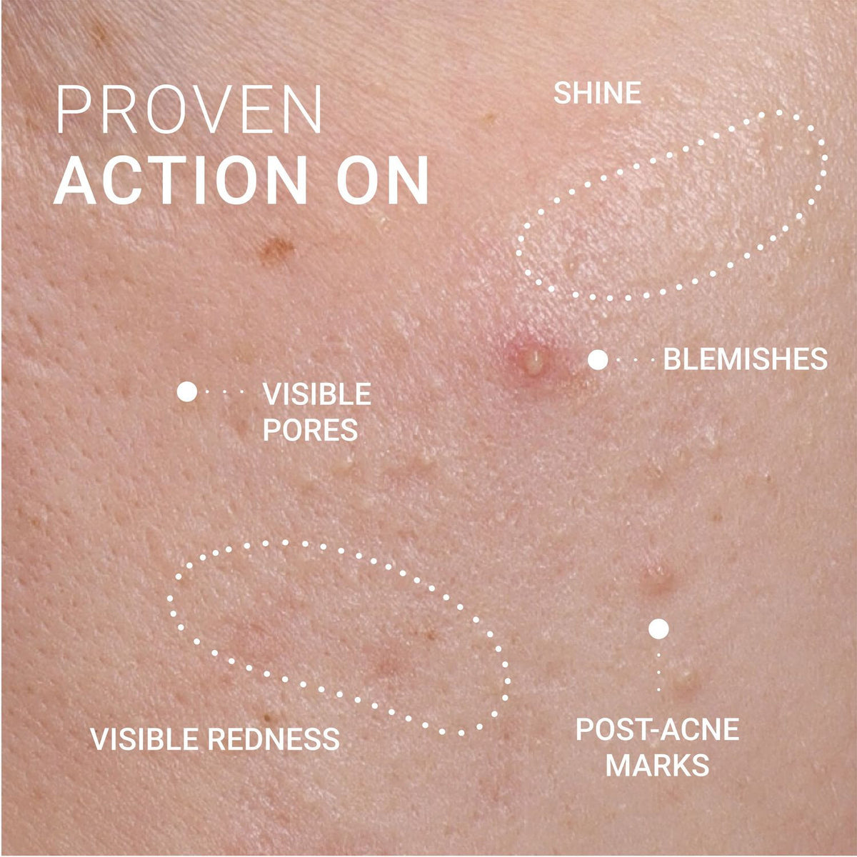 Corrective Serum